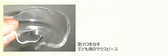 受け口を治す子ども用のマウスピース