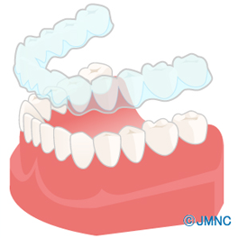 img_bruxism_cause01.png