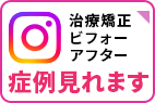Instagram　矯正治療ビフォーアフター症例見れます
            