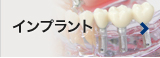 インプラント