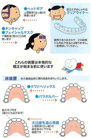 矯正治療３