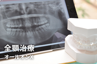 全顎治療オールオンX
