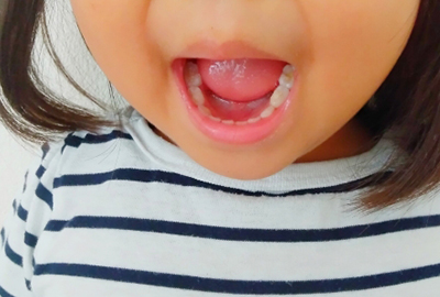 子どもの歯