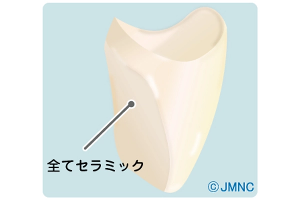 オールセラミッククラウンとは?