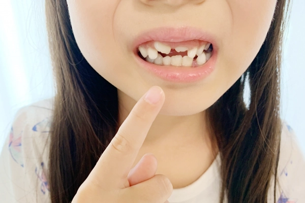 小児矯正