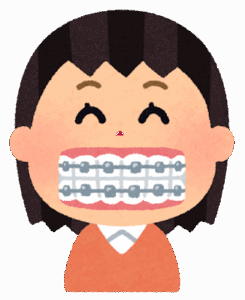 ワイヤー矯正の経過