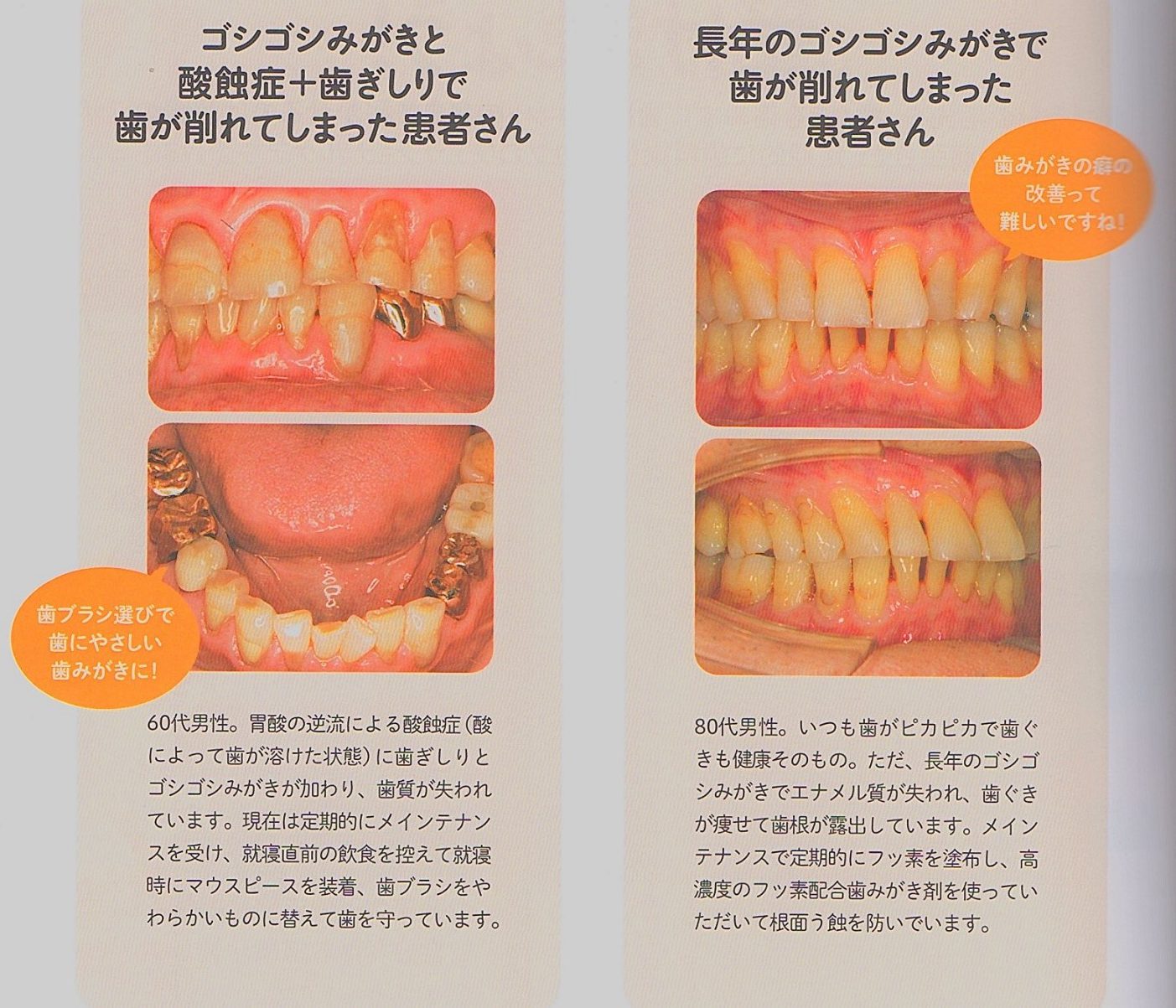 2021年8月｜歯の豆知識｜えんどう歯科・矯正歯科クリニック